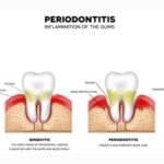 what is a periodontist